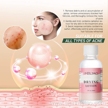 Effective Pimples Dark Spot Remover Cream Drying Lotion